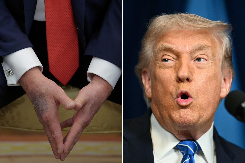 Trump boasts about "perfect health" after dismissing age concerns in testy interview