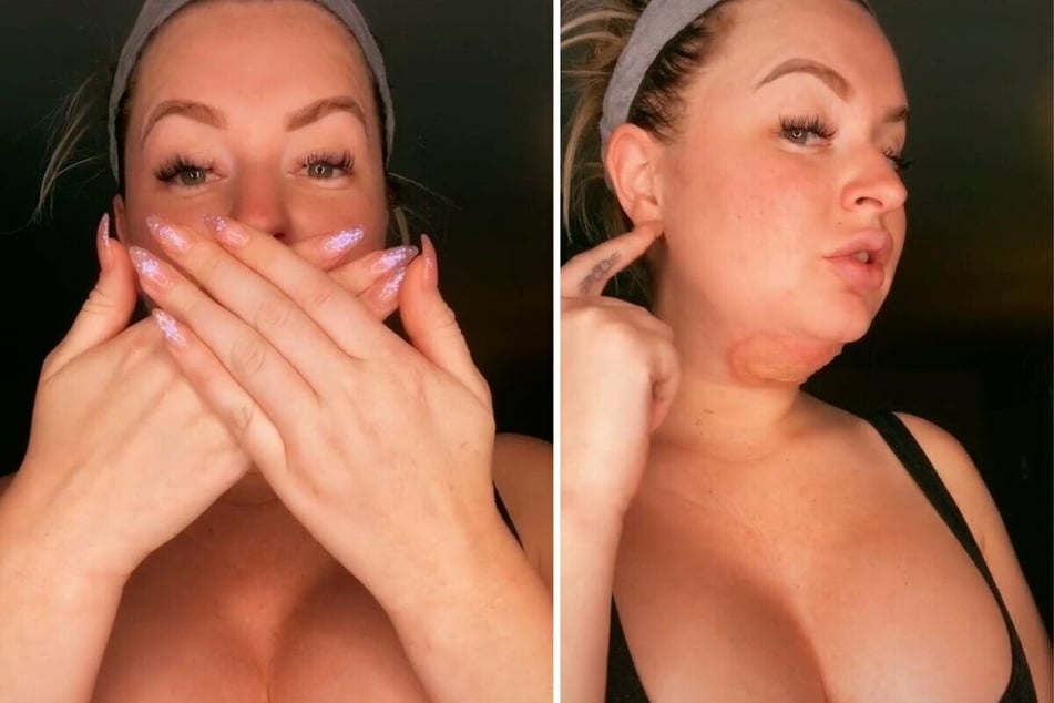 TikToker shares horrific beauty procedure that scarred her for life