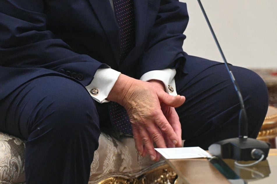The hands of President Donald Trump as he attends a meeting at Bestepe Presidential Compound in Ankara, Turkey, during the NATO Summit on July 7, 2026.