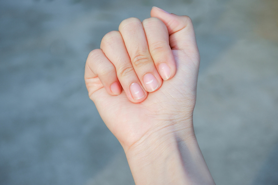 White dots on the nails (leukonychia) often indicate a lack of zinc or calcium.