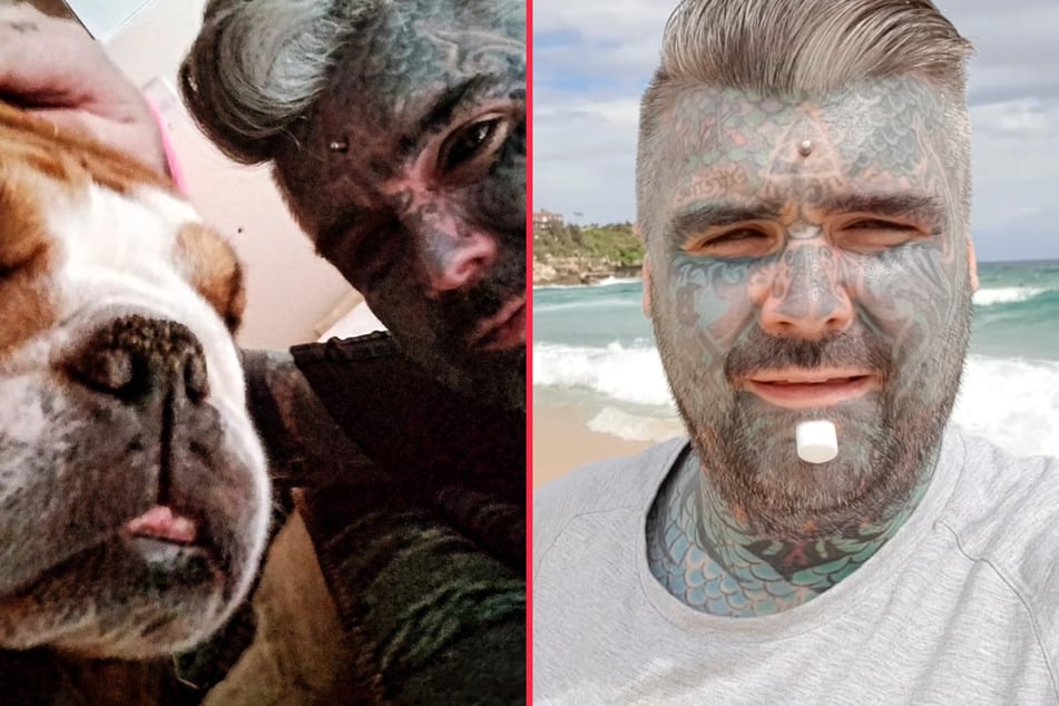 Mathew Whelan, often referred to as Britain's most tattooed man, almost lost his arm due to an implant-gone-wrong.