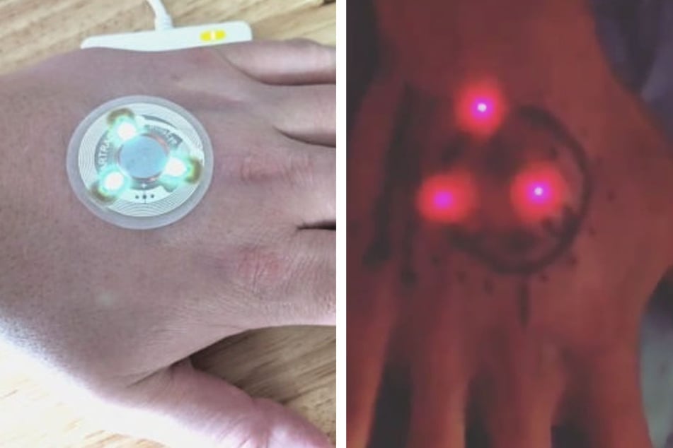 RFID implants are placed under the skin either professionally or at home with Dangerous Things implant kits.