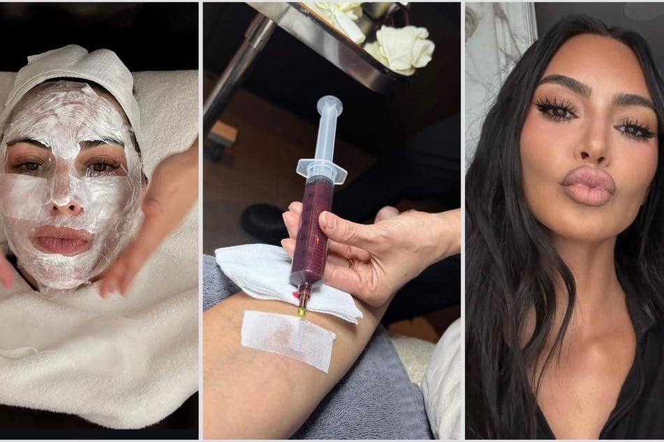 Kim Kardashian freaks fans out with bizarre beauty treatments in Korea
