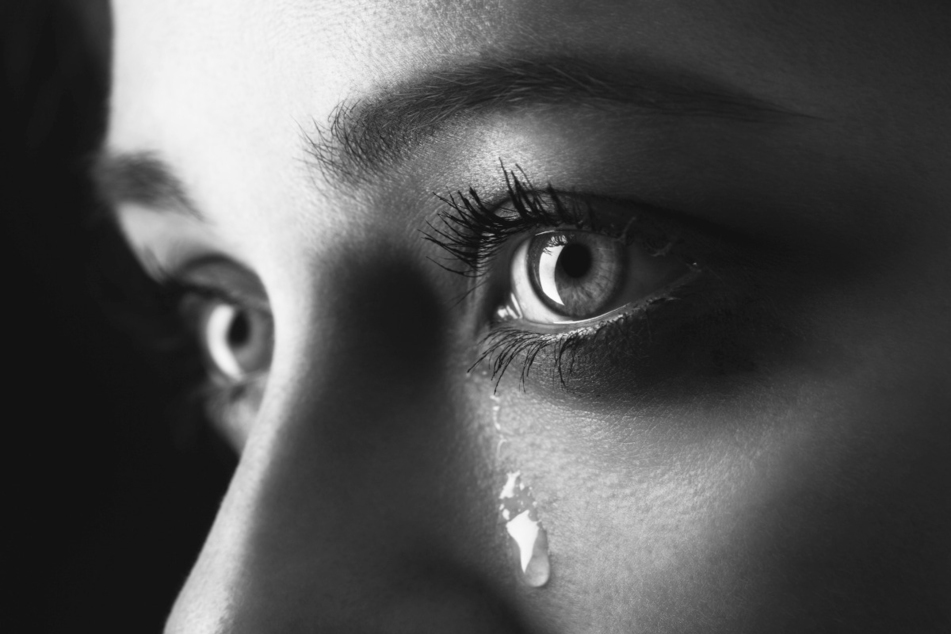 Hemolacia means "bloody tears" and involves blood leaking from one or both eyes (stock image).