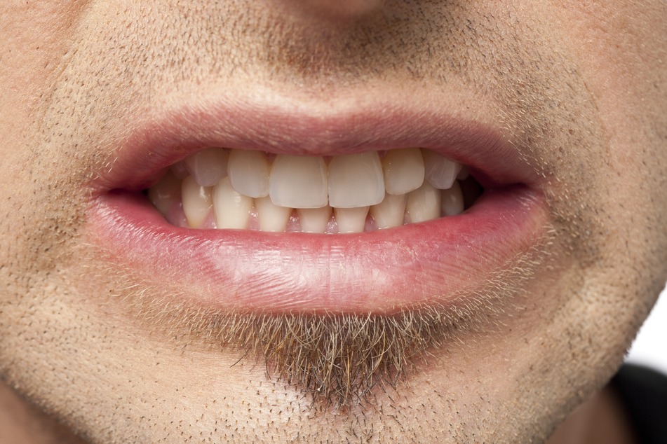 Stress from Covid-19 leads to surge in teeth grinding