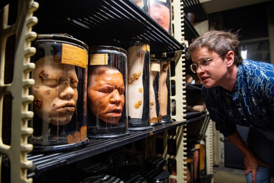 Sara Ray, senior director of interpretation and engagement at the Mutter Museum Historical Medical Library, examines wax models of the faces of patients who suffered from leprosy.
