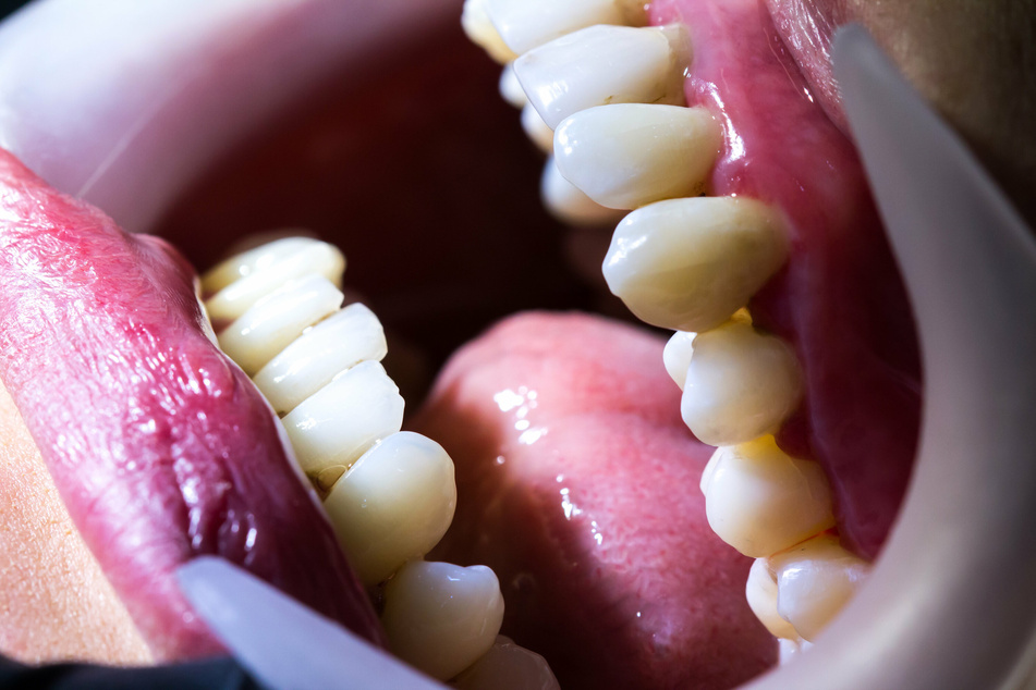 Dirty dentistry: Woman admits to breaking into a dental office just to pull someone's teeth