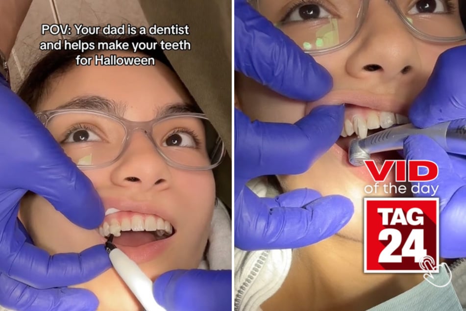 Viral Video of the Day for October 31, 2023: Dentist dad gives daughter a fang-tastic Halloween makeover