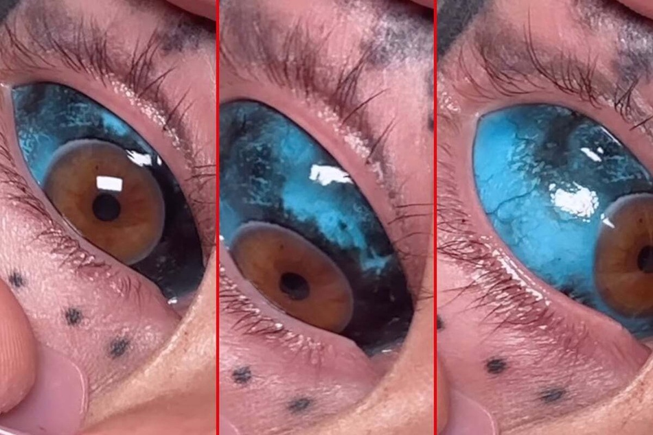 Amber Luke got a new clouded pattern tattooed into her eyes.