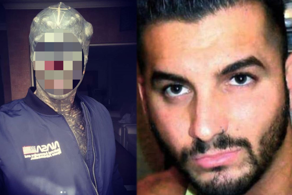 Man without nose and ears wants to look like an alien