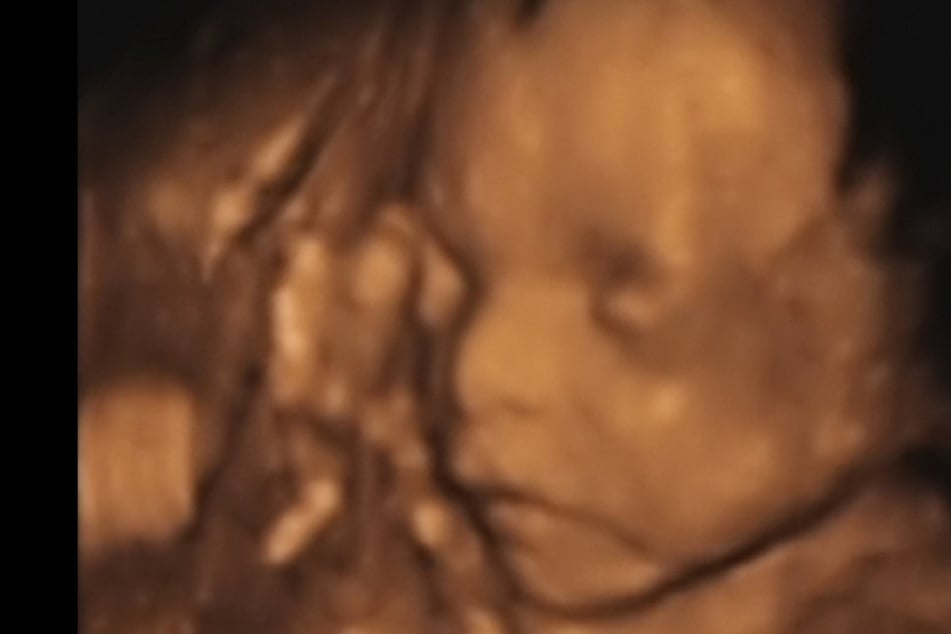 Apparently, babies in the womb are not big fans of the leafy green stuff (stock image).