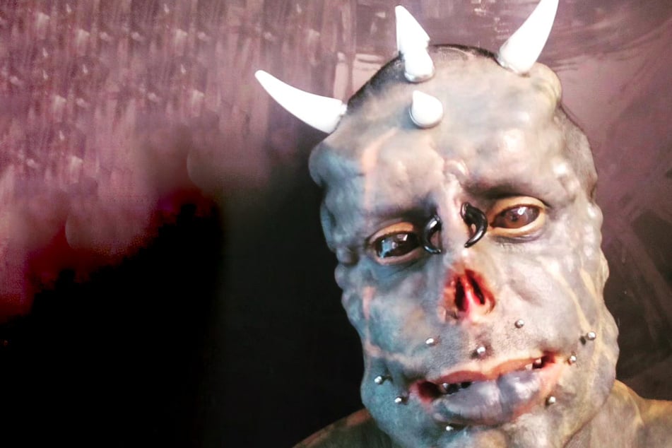 This is the man with the most human horn implants