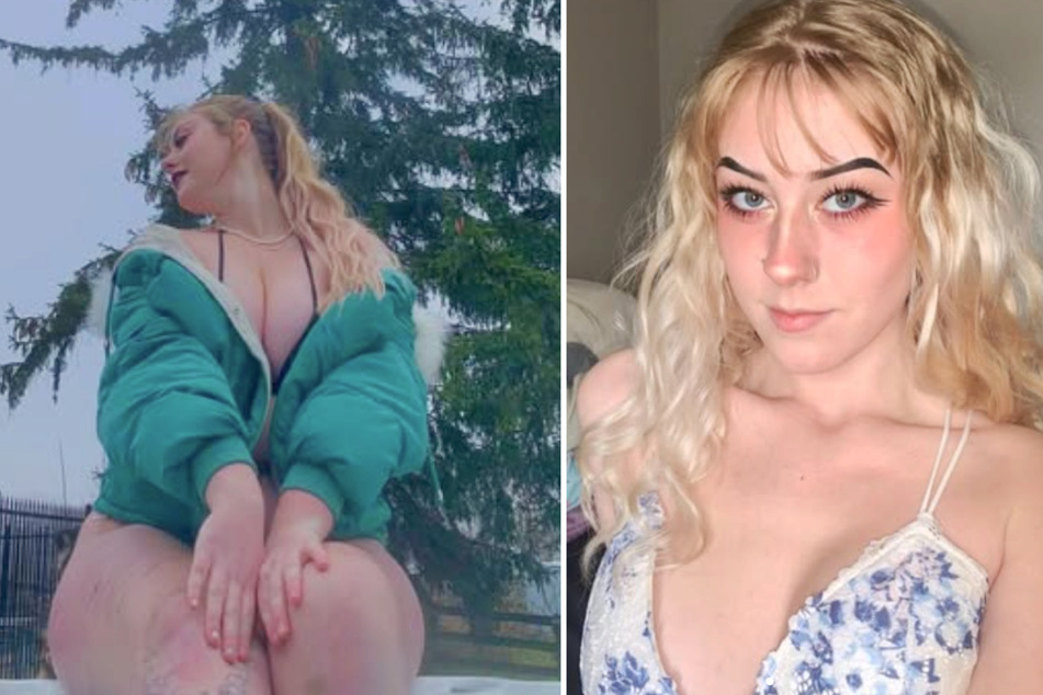 Aleigha Cartmen had her breasts reduced in Turkey and two of her tattoos disappeared in the process.