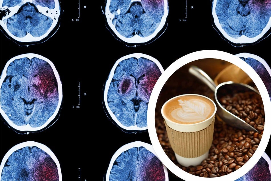 Swiss study shows caffeine can shrink your brain