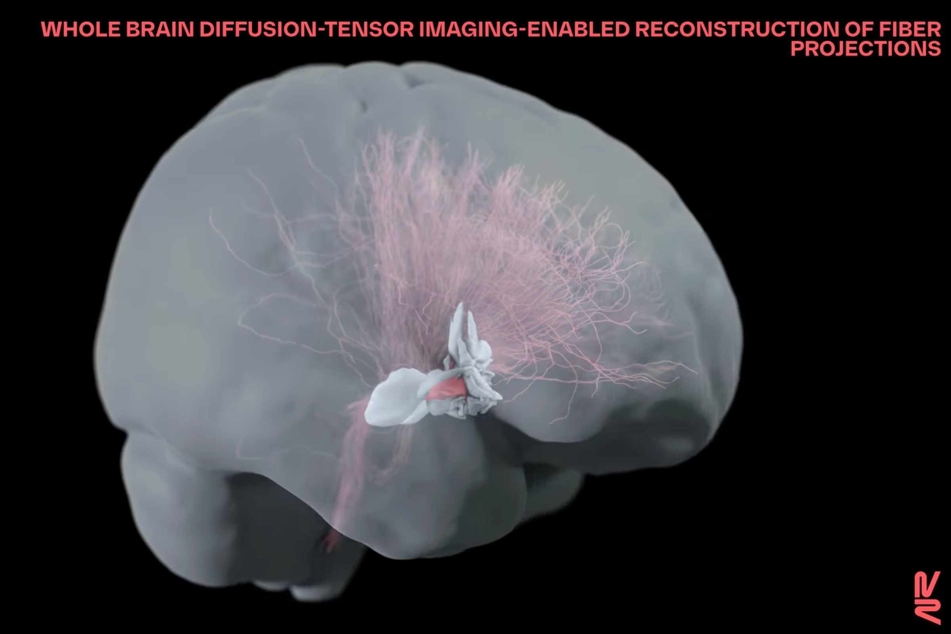 Using 3D imaging techniques to map out the brain activity of mice with these injuries, the team created what they called a "brain-wide atlas."