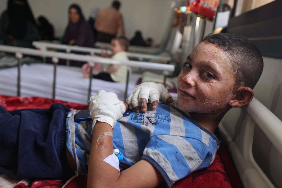 A Palestinian boy receives treatment at a clinic set up by Doctors Without Borders for injuries and burns sustained in Israeli bombardment, at the Rafah Indonesian Field Hospital in the southern Gaza Strip.