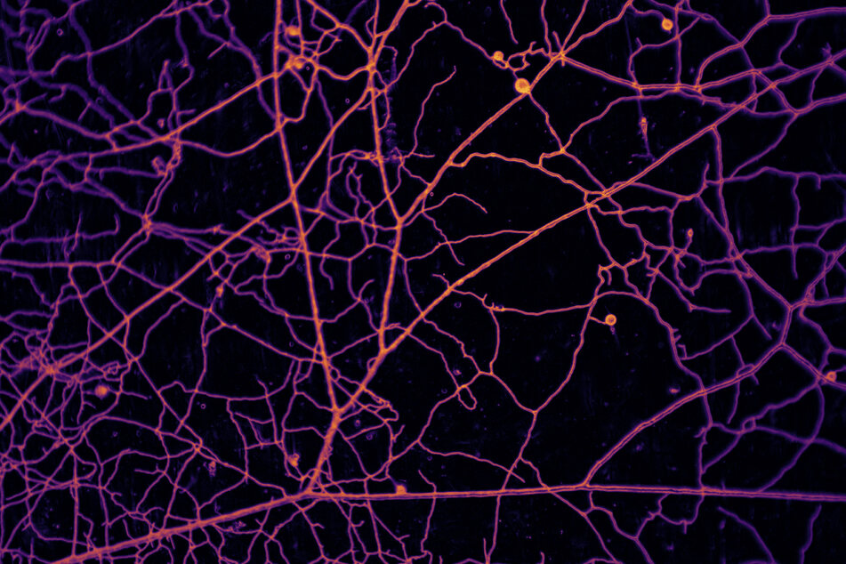 A picture provided by the Vrije Universiteit Amsterdam shows a microscopic image of a network formed by arbuscular mycorrhizal fungi.