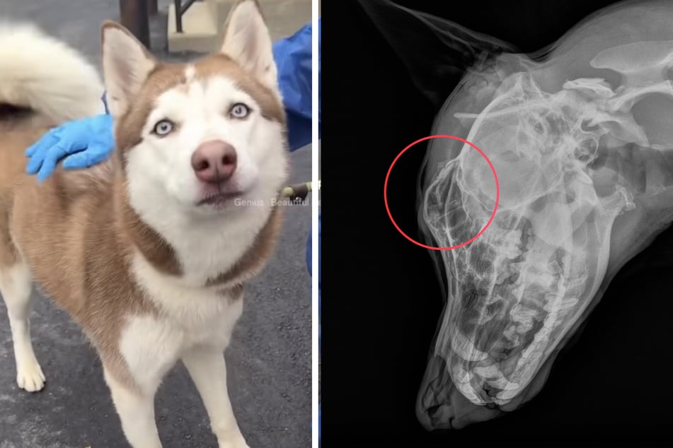 Justice's skull had been fractured as a result of blunt force trauma/