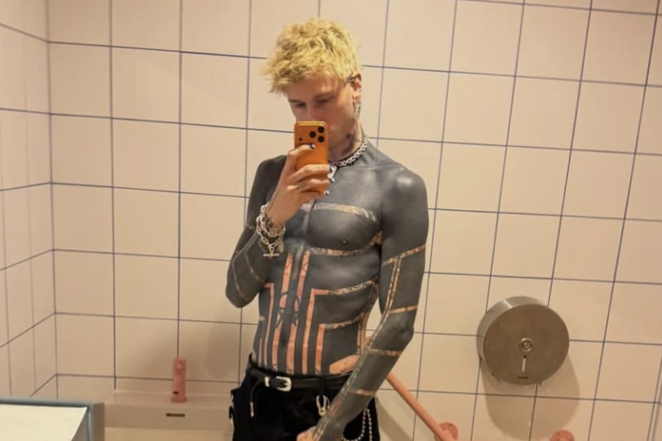MGK had large portions of his upper body tattooed black, which led to severe health problems.