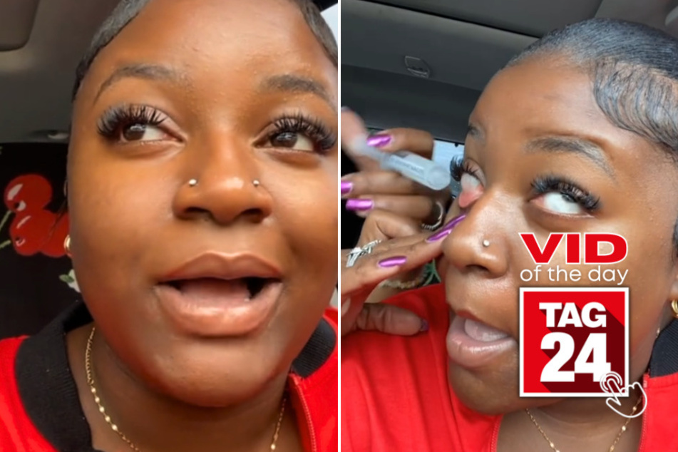 Viral Video of the Day for July 16, 2024: Mom flushes out daughter's eye in hysterical viral TikTok!