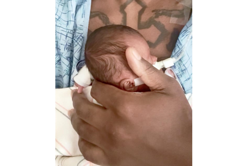 Jonah is currently still in the neonatal intensive care unit.