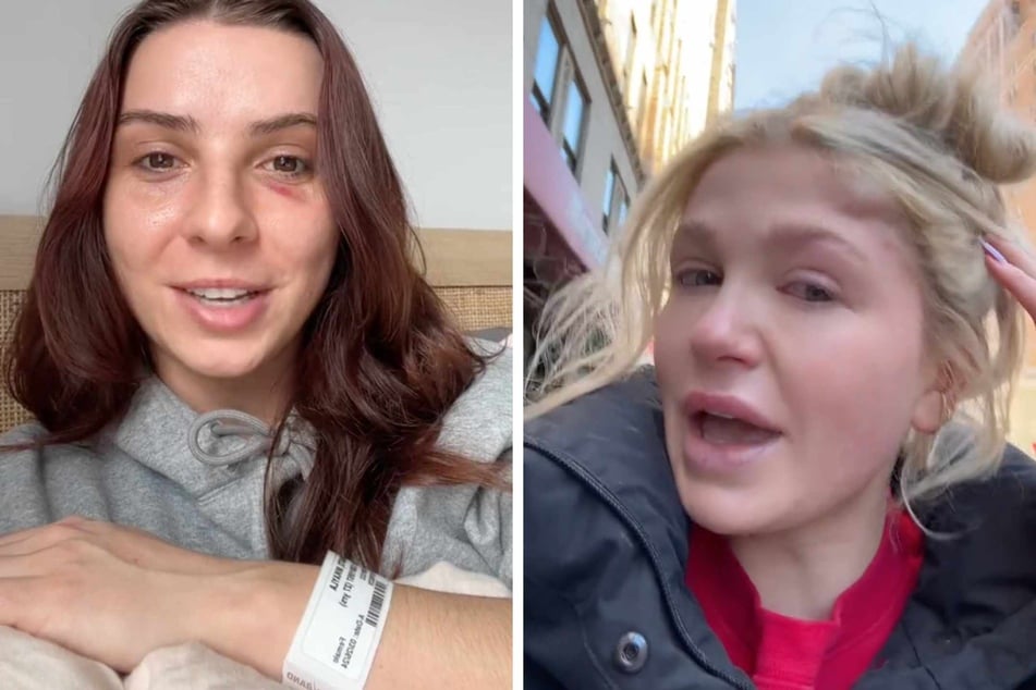New York City women's TikTok stories of random punches lead to arrest
