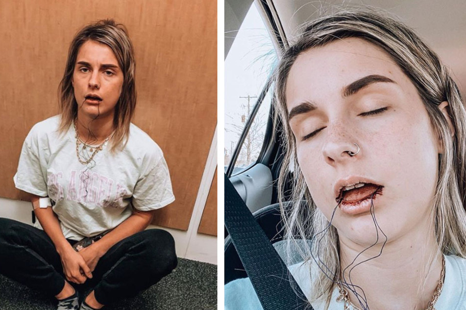 Heavily-medicated woman thinks she's in Grey's Anatomy after coming out of dental surgery!