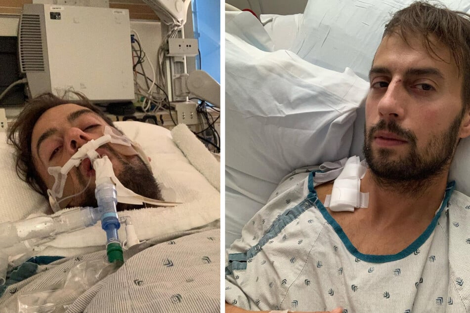 Ryan Fischer was hospitalized after being shot in the chest while walking Lady Gaga's French bulldogs.