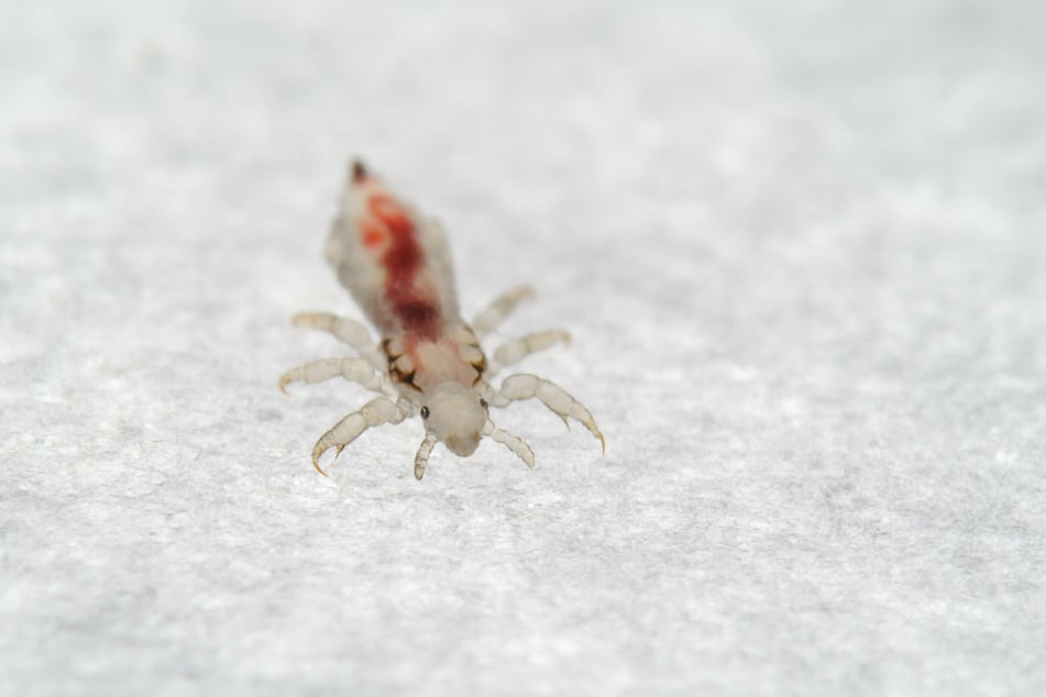 It's often hard to detect head lice with your bare eyes.