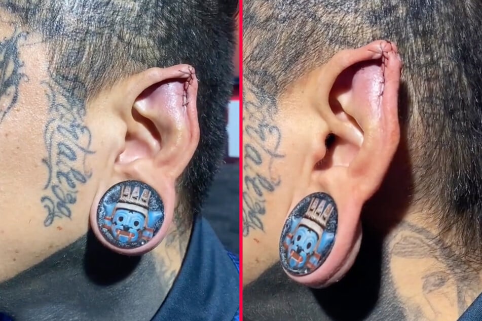 Tattooed man mutilates ear to make himself look like an elf