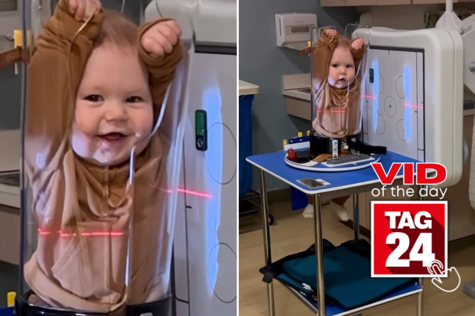 Viral Video of the Day for January 31, 2024: This baby can't stop smiling – even during an X-ray!