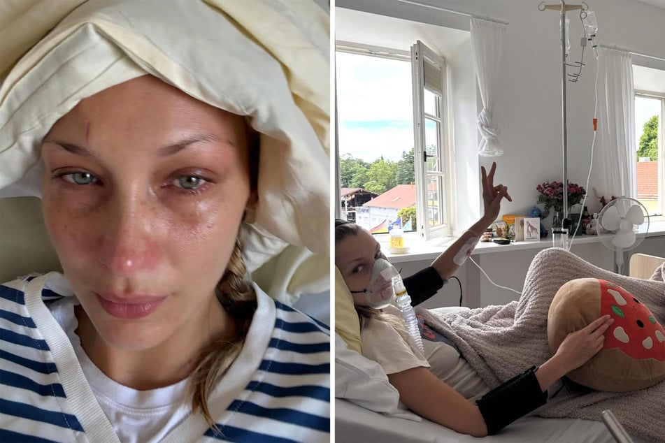 Bella Hadid recently opened up about her latest flare-up caused by her Lyme disease and the affect it has on physical and mental health.