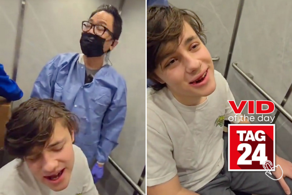 Viral Video of the Day for March 10, 2024: Wisdom tooth extraction turns into stunning musical performance!
