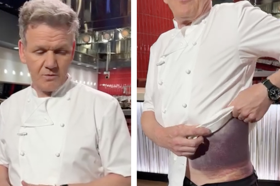 Celebrity chef Gordon Ramsay had a serious bike accident last week.