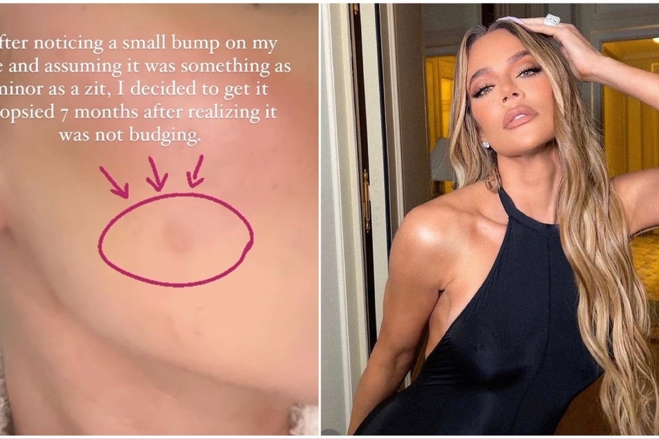 Khloé Kardashian reveals shocking cancer scare
