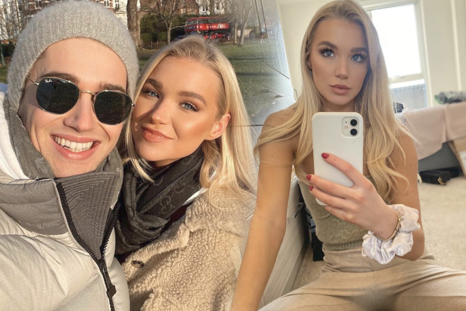Life hack gone wrong: dancer suffers terrible burns and has to live with consequences