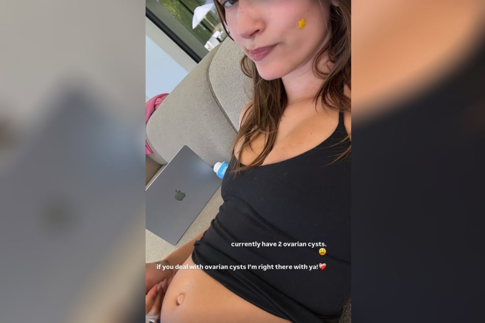 Hailey Bieber revealed on Monday that she's been struggling with ovarian cysts.