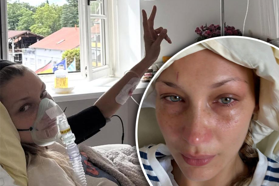 Bella Hadid tearfully reveals "severe isolation and depression" caused by Lyme disease